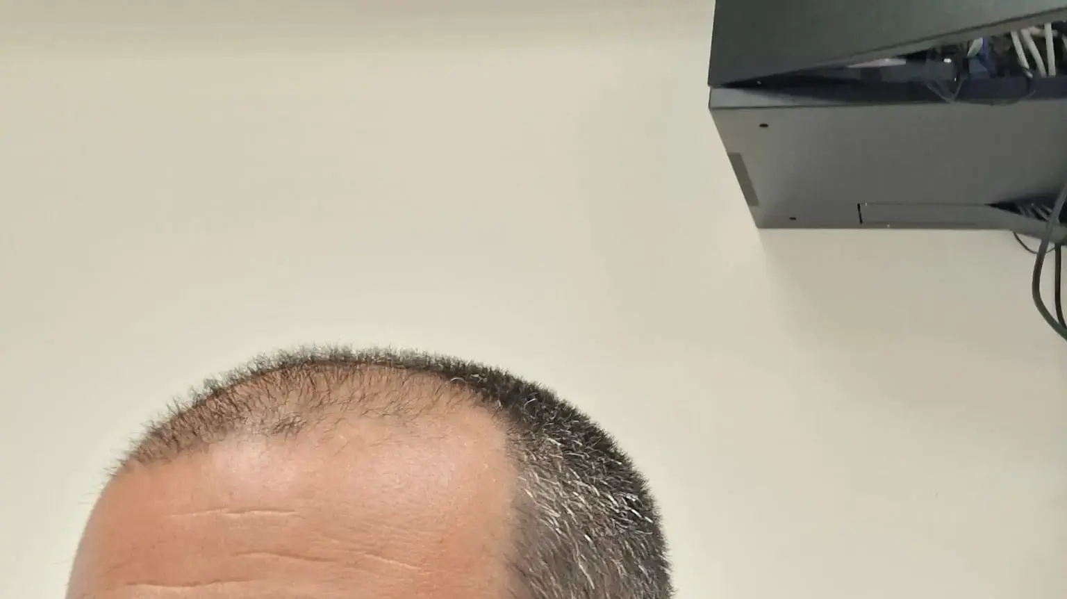 שלומי (״שוקו״) שבתאי, הלום קרב שהותקף בבני ציון 