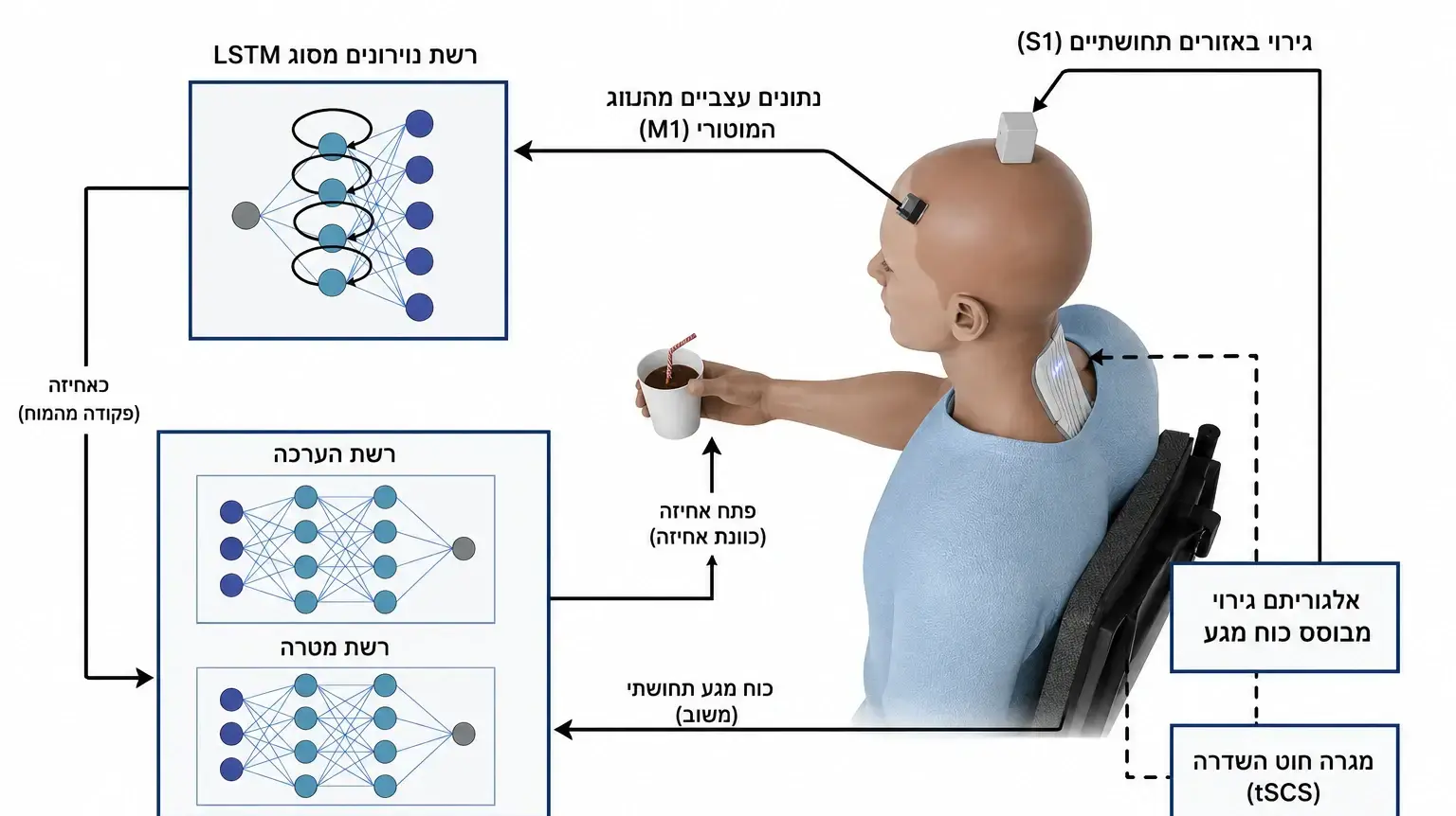 כך פועלת המערכת שהצליחה לגרום למשותק להניע את ידיו כך פועלת המערכת שהצליחה לגרום למשותק להניע את ידיו