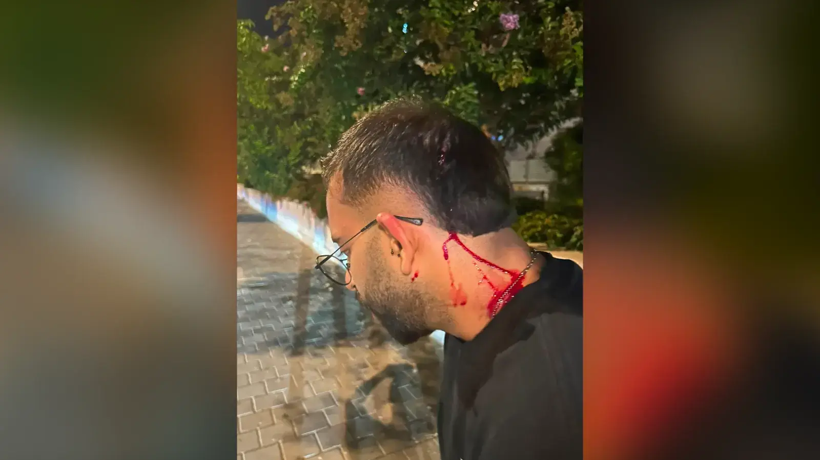 ריב על חנייה שהתפתח לעימות אלים, כפר יונה, אוגוסט 2026