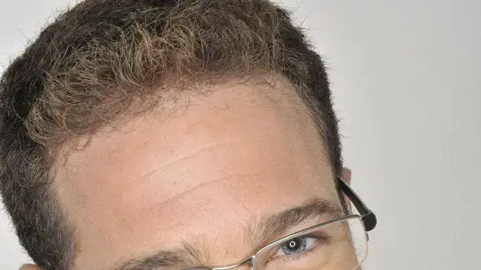 איתי זיו