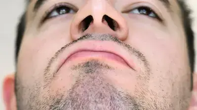 אילוסטרציה אילוסטרציה