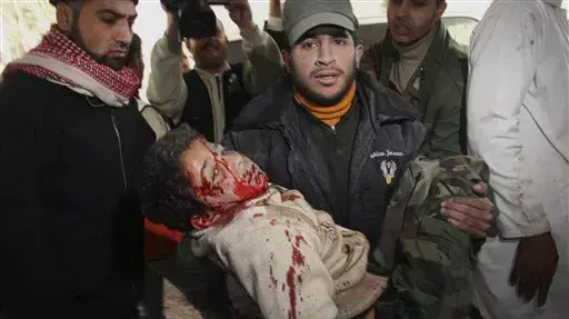 פלסטינים פצועים אחרי הפצצת צה"ל בית ספר של האו"ם בעזה פלסטינים פצועים אחרי הפצצת צה"ל בית ספר של האו"ם בעזה