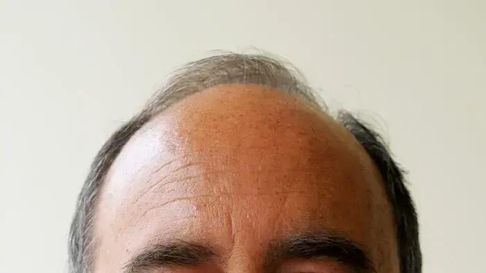 אריק בכר