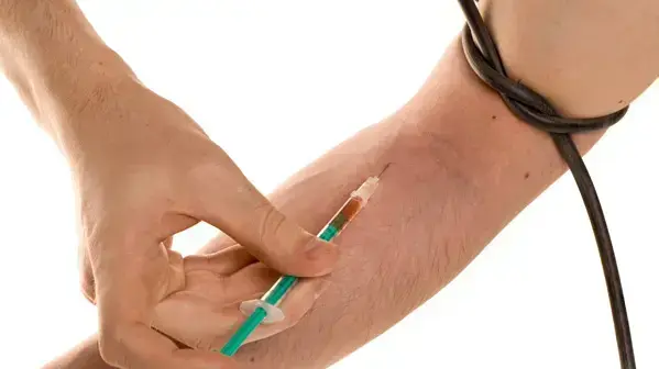 אילוסטרציה