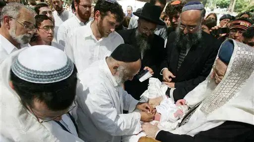 ברית מילה 