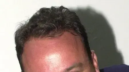 אריק קליין