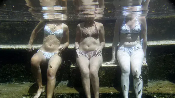 טיפול בפסוריאזיס באמצעות דגים טיפול בפסוריאזיס באמצעות דגים