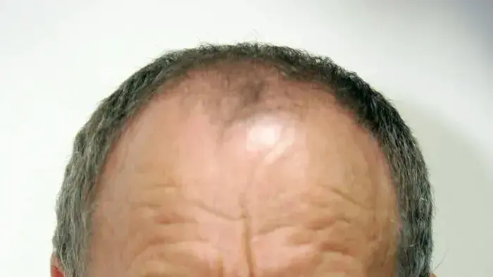 אולג קרליק