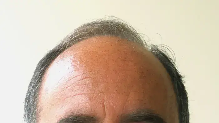 אריק בכר, מזכ"ל 