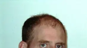 רון גרליץ, מנכ"ל עמותת סיכוי