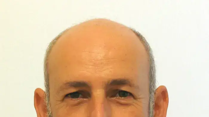 דביר אינטרטור דביר אינטרטור
