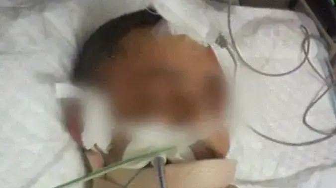 מחר יוגש כתב אישום נגד הצעיר שתקף את איפרגן עם קסדה