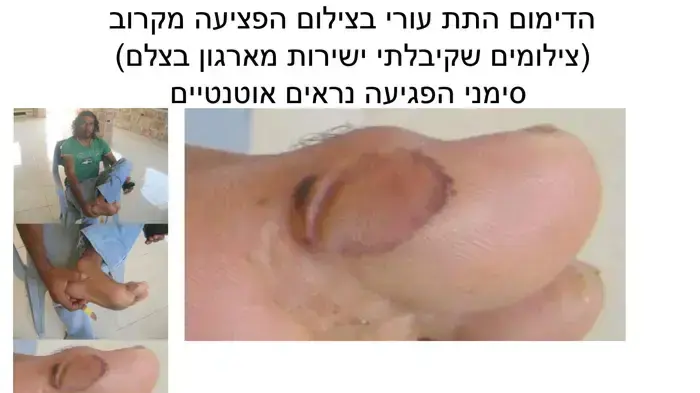 תחקיר ניעלין חלק ב'