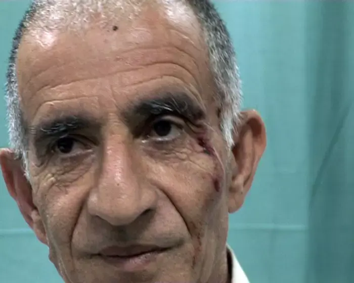 התהפכות האוטובוס בכביש 6: "הנהג נרדם על ההגה"
