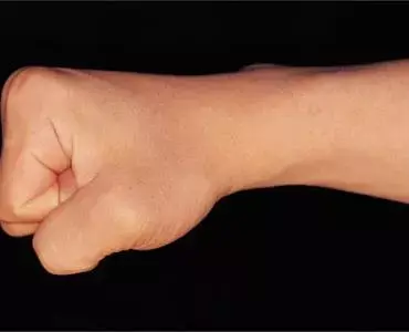השר האוסטרלי הקשוח קיבל אגרוף בפנים