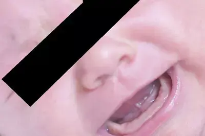 תינוקת מטבריה אושפזה במצב קשה