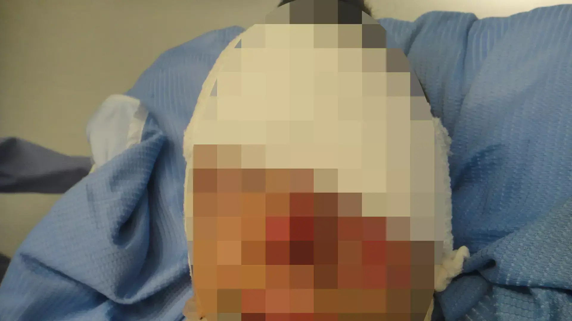 המשחק בנפצים נגמר באסון: נער איבד ראייה בעינו