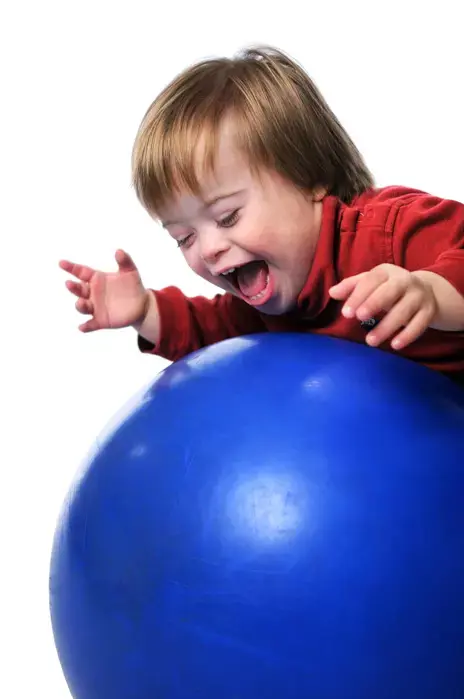 האם תה ירוק יכול לשפר יכולות שכליות באנשים עם תסמונת דאון?