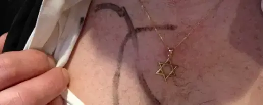 עלייה באנטישמיות בצרפת: מספר התקריות נגד יהודים הוכפל