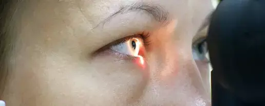 דברים שלא ידעתם על הגורם מספר אחד לעיוורון בלתי הפיך