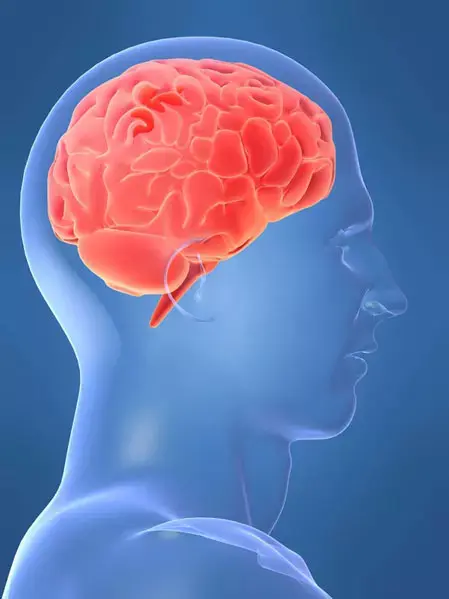 חולי סוכרת? כדאי שתישמרו משבץ מוחי