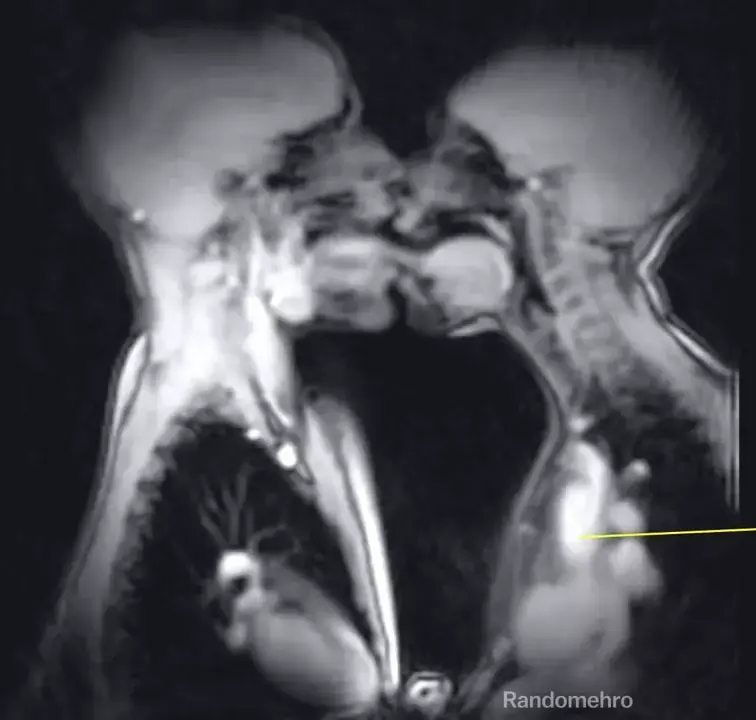 סקס בתוך מכונת MRI: זוג נכנס למכשיר "בשם המדע" וגילה תגלית מדהימה
