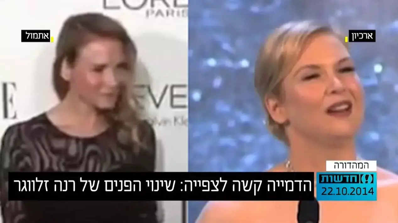 הדמייה קשה לצפייה: שינוי הפנים של רנה זלווגר