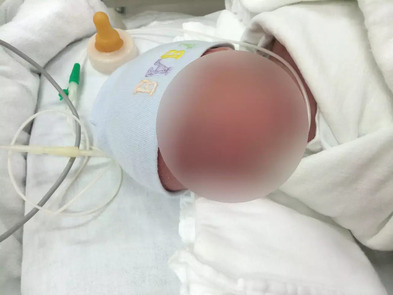 "בין תקווה לייאוש": ערב התרמה ליוגב הקטן שמאושפז בתאילנד