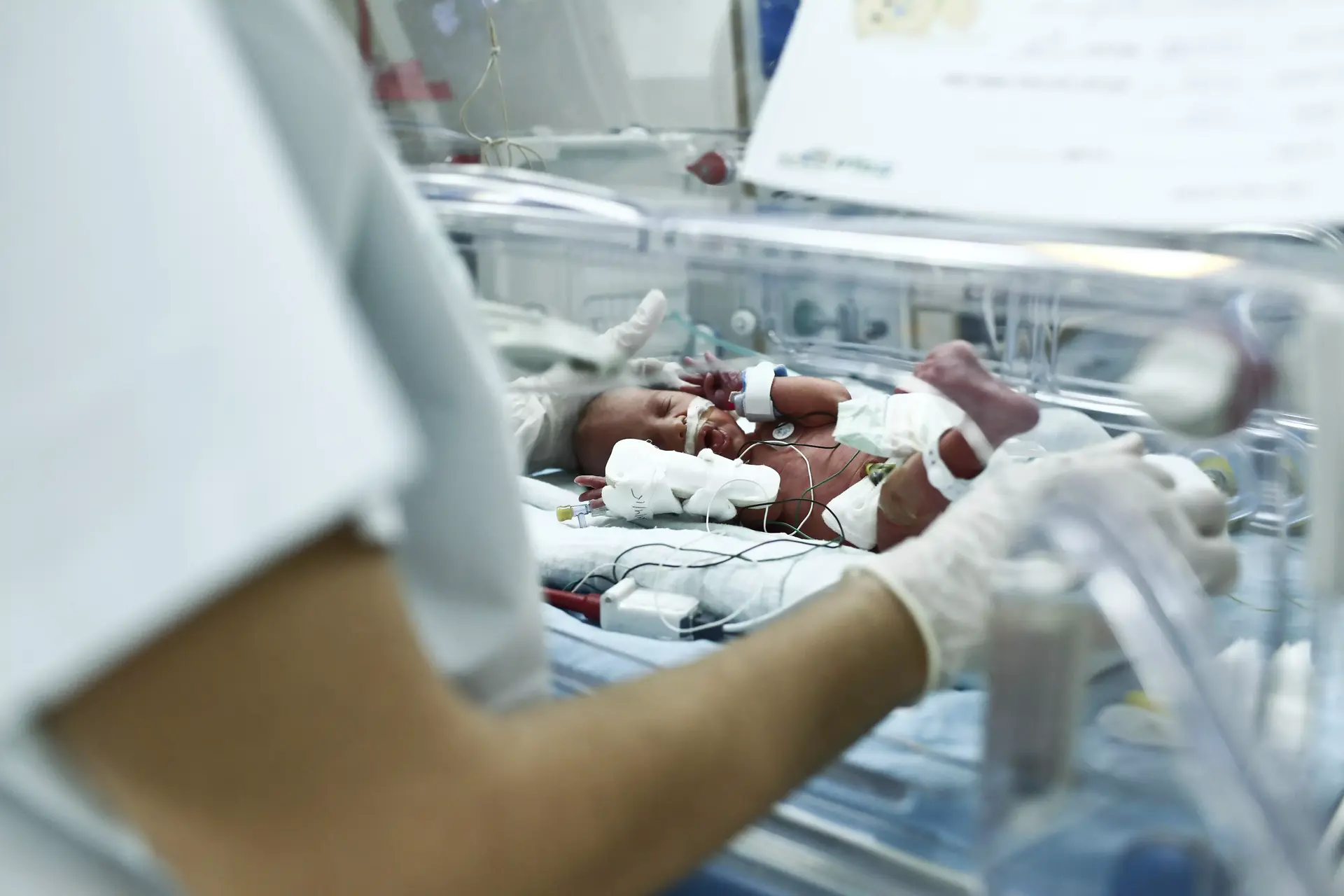 9 חודשים לצוק איתן: שתי שלישיות בשעתיים ועומס בחדר יולדות
