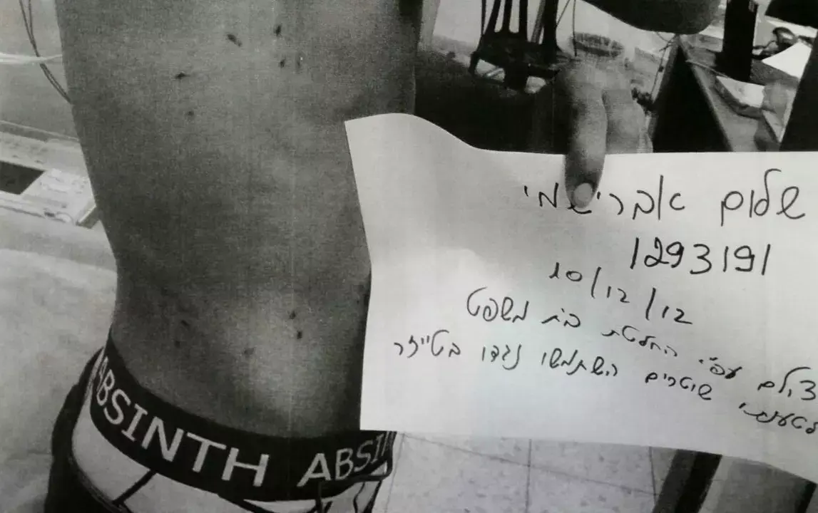 שימוע לקראת אישום נגד שוטרים שחישמלו עבריין בטייזר