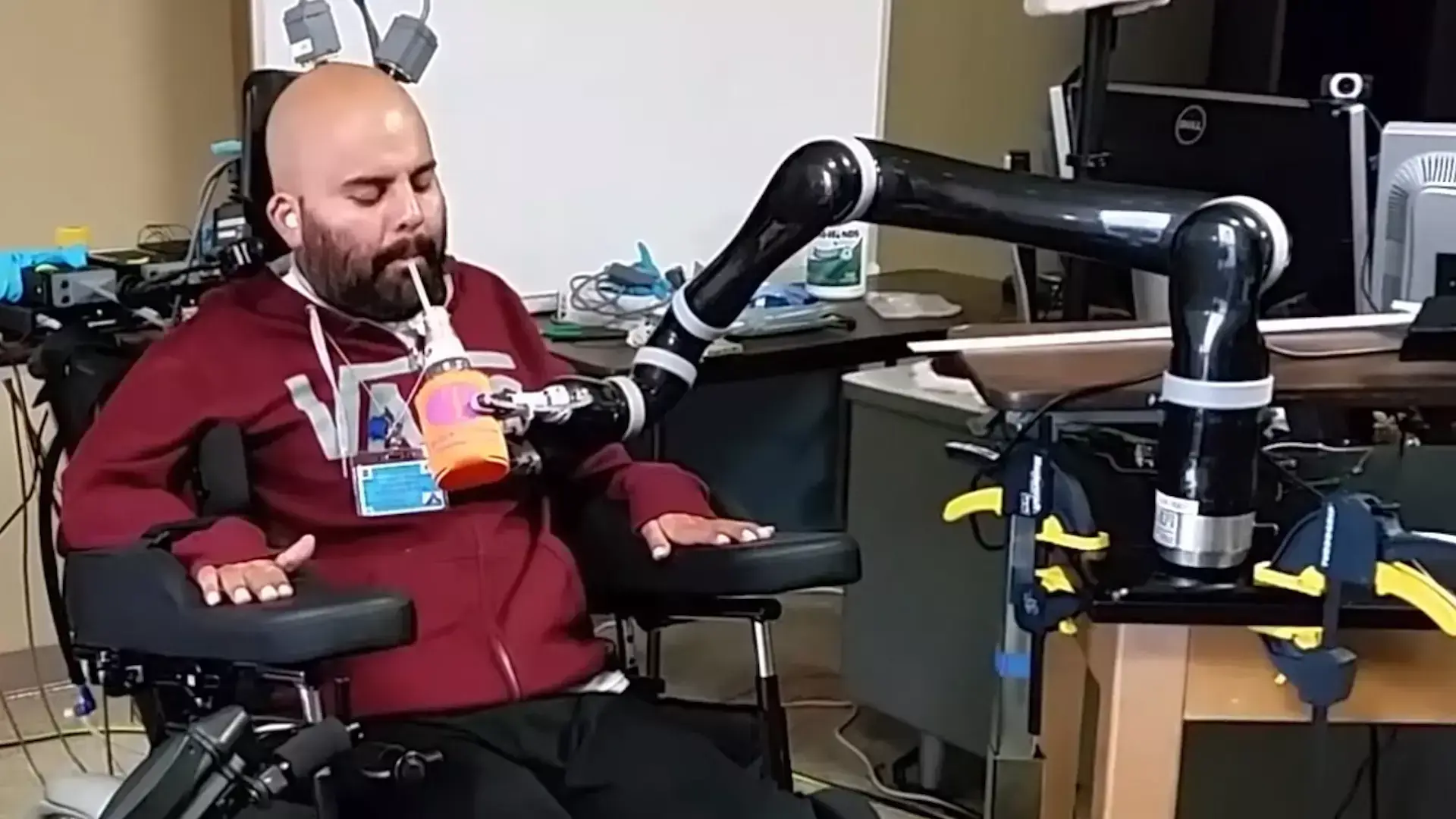 החדשות בדקה | צפו: נכה הזיז זרועות מכניות בכוח המחשבה