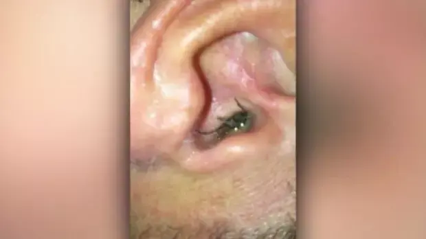 הסרטון של העכביש שהגעיל את העולם התגלה כמזוייף