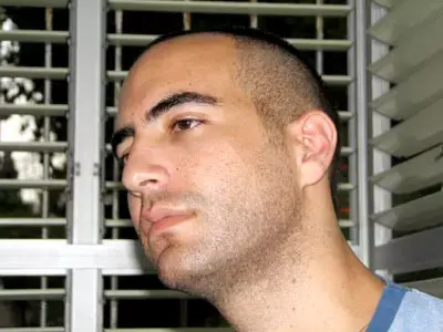 חולה סופני נבחר להשתתף במחקר חדש בארה&rdquo;ב