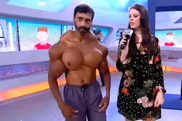 צפו בגבר שמוכיח שיש דבר כזה יותר מדי שרירים