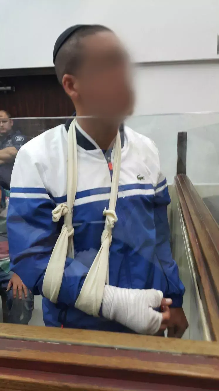צעיר התלונן במח"ש: שוטרים התעללו בי במעצר ושברו את ידי