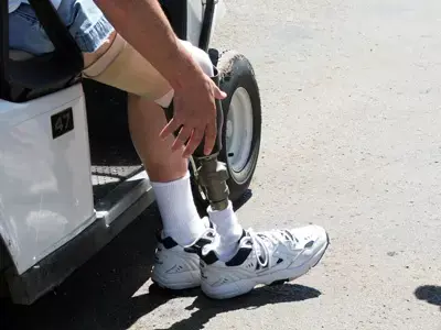 מי כל הזמן גונב למליסה את הרגליים התותבות???
