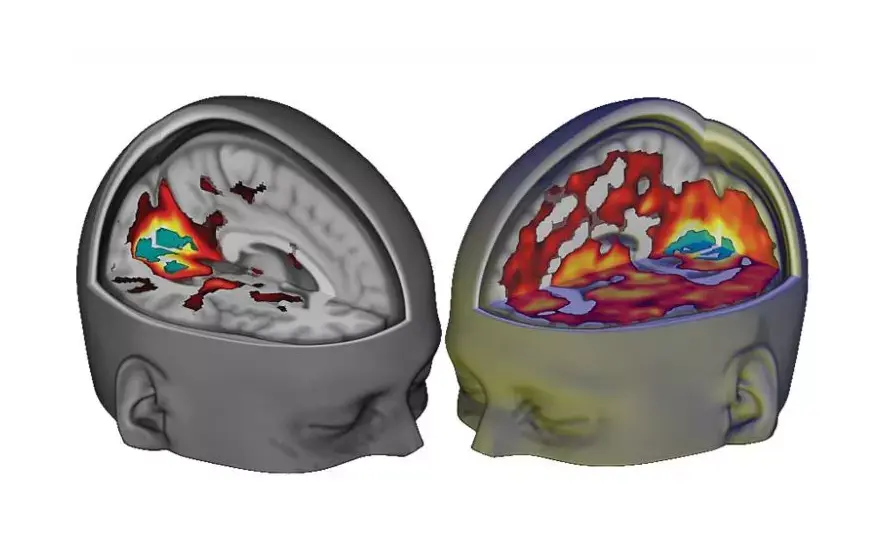 מטורף: ככה נראה מוח על השפעת LSD