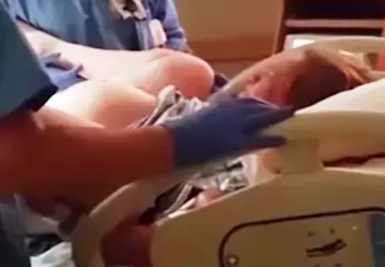 מה הקשר בין שימוש באפידורל ודיכאון לאחר לידה?