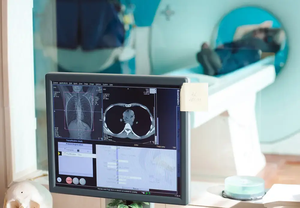 האקדח נשלף והרג: אסון טראגי במכשיר ה-MRI