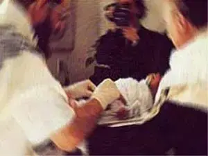 ברית מילה מקטינה סיכוי לאיידס