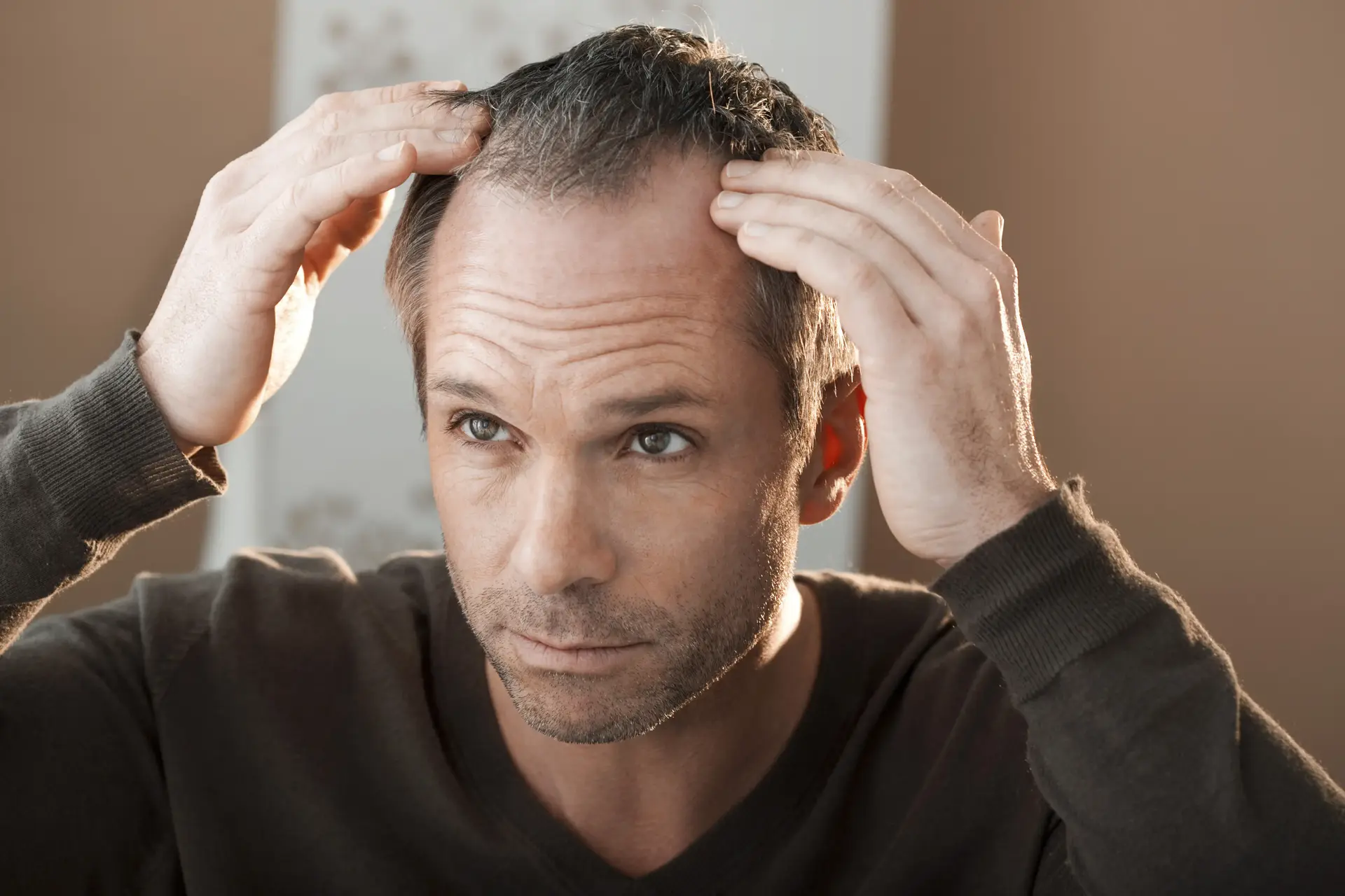התקרחות או נשירת שיער? כך תדעו לזהות
