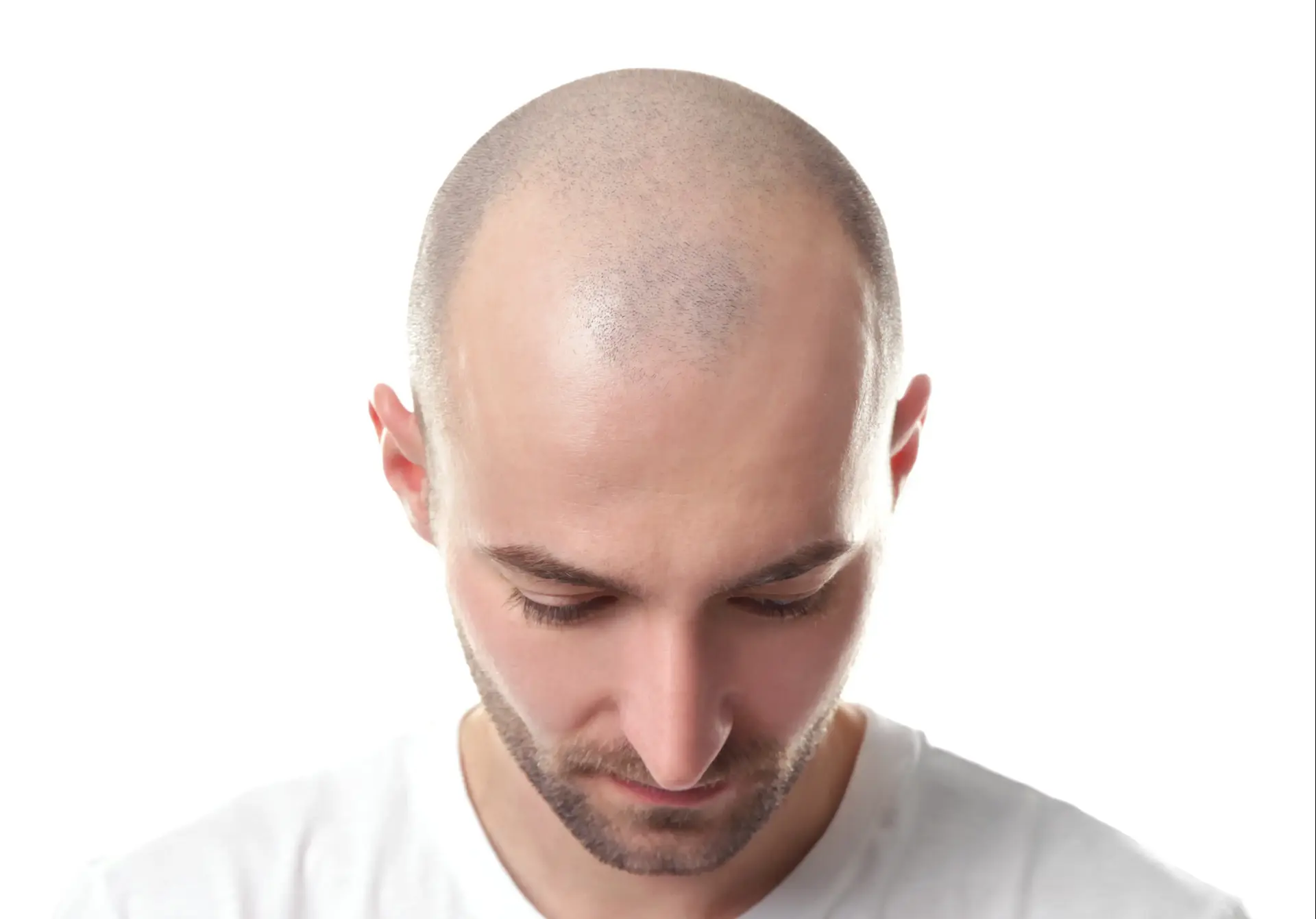 עכשיו זה שלכת: איך אפשר להפחית את נשירת השיער?