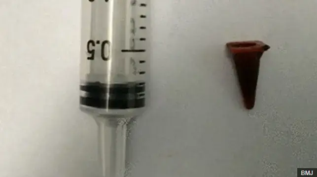 הרופאים חשבו שזה גידול, הבדיקה הראתה דבר מוזר מאוד