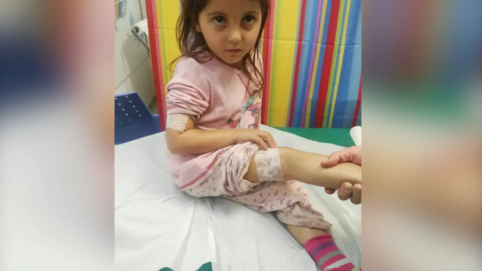 גל מקרי כלבת בצפון: מה עושים במקרה של נשיכת תן?