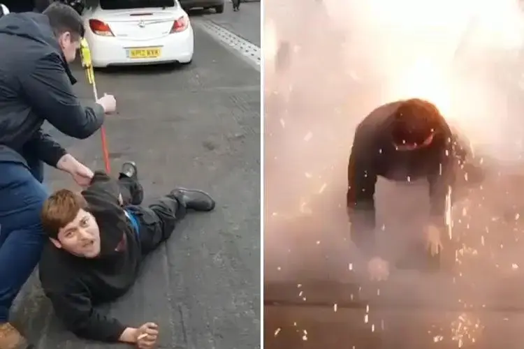 אל תנסו את זה בבית: כך נראה אדם עם זיקוק מתפוצץ בישבן