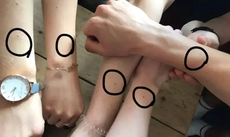 נשים מגלות בתדהמה שלרובן יש נמש במקום המוזר הזה