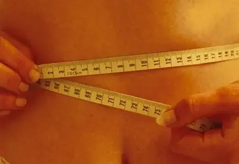 גרות בעיר? סיכוי גבוה שתחלו בבולמיה