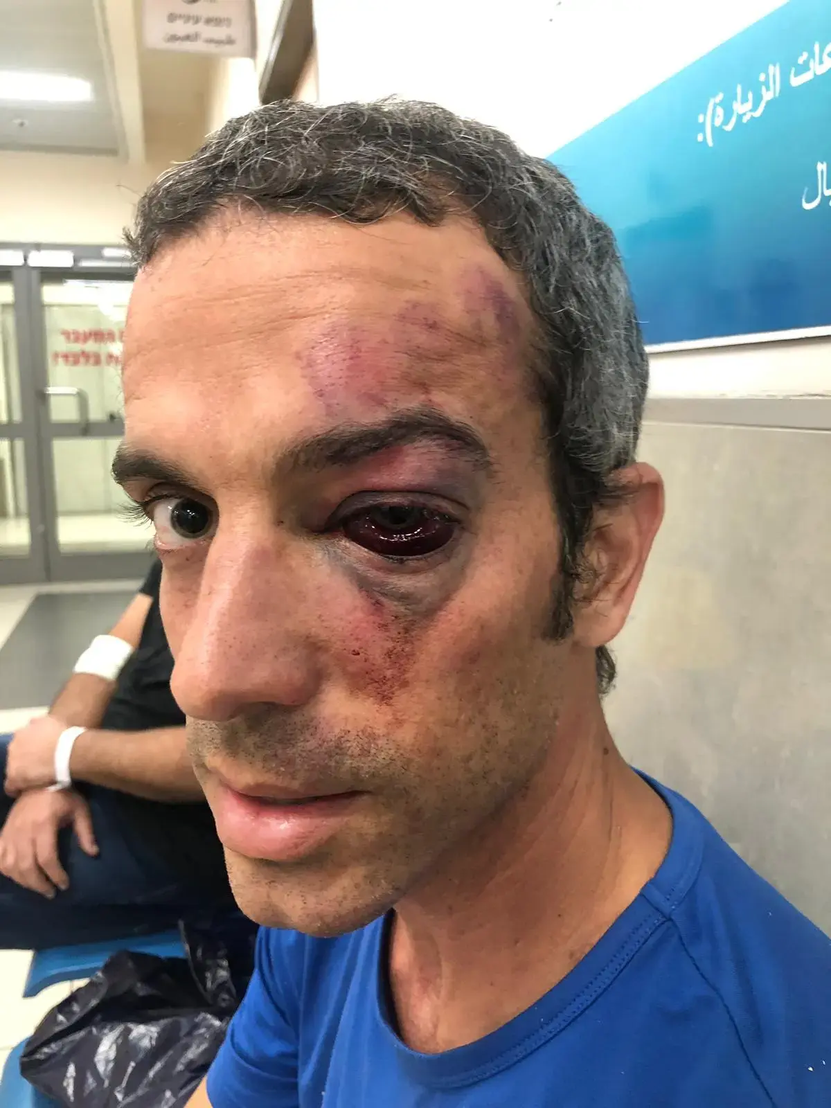 העיר לאורחי הצימר שקטפו פירות בחצרו - והותקף: "צעקתי לעזרה"