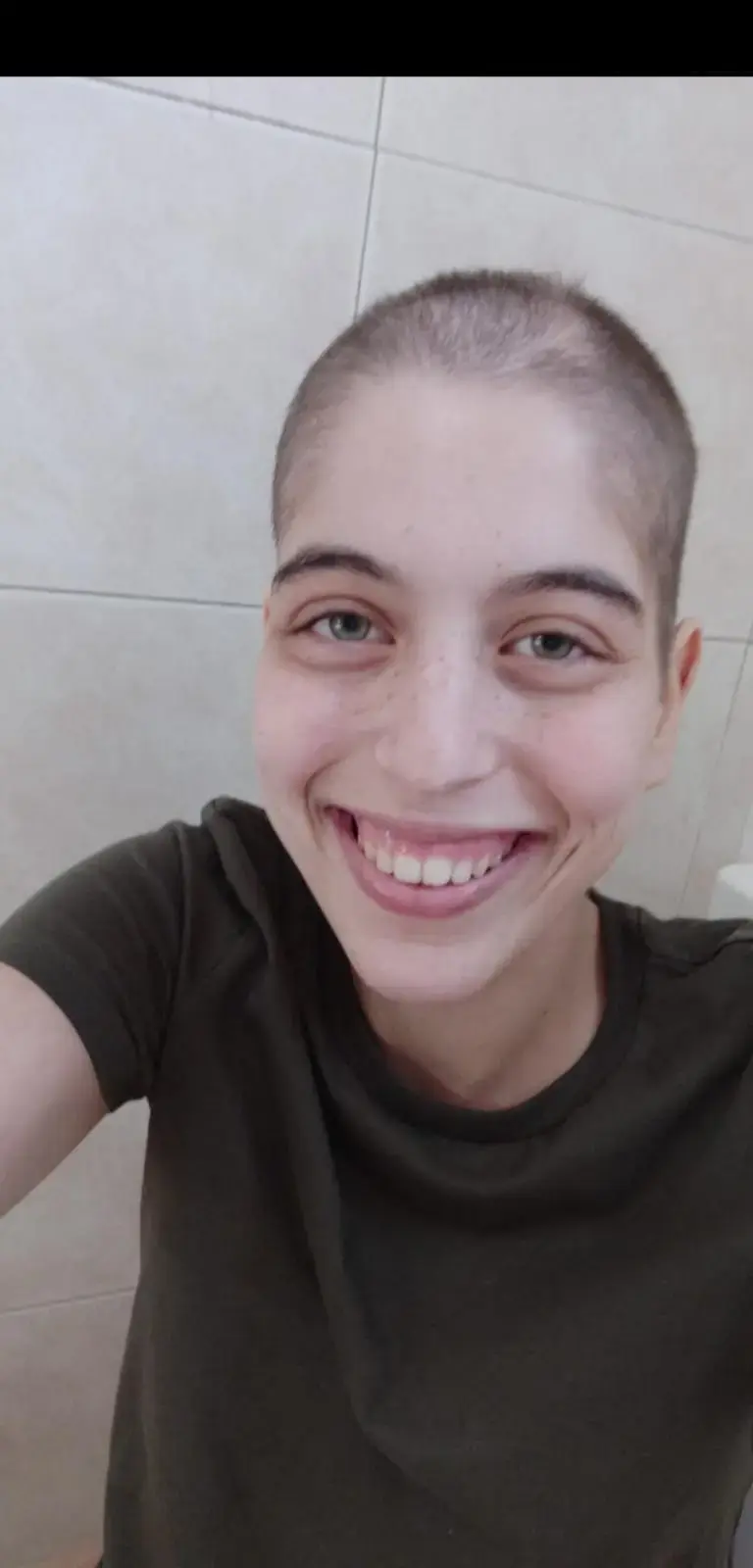 תרומת שיער היא עניין של חיים ומוות, לא פחות