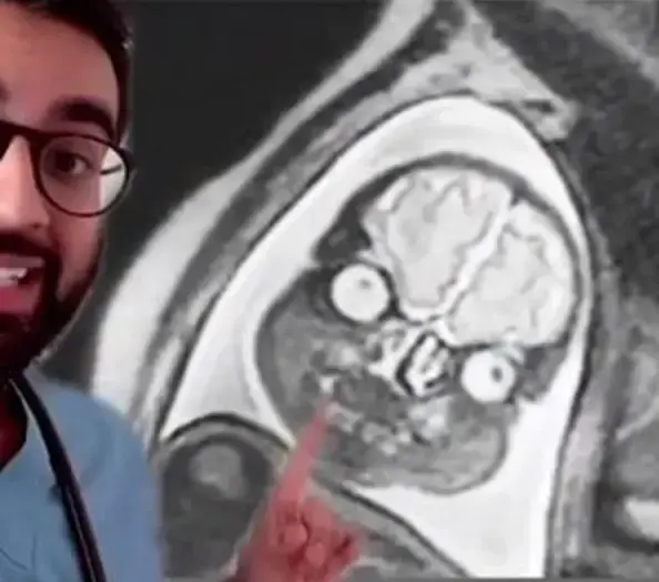 הטרנד הבריאותי של קים קרדשיאן: סריקת MRI לכל הגוף לאיתור 500 מחלות - שווה?